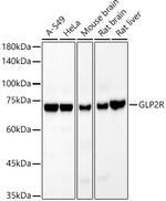 GLP2R Recombinant Rabbit Monoclonal Antibody (6Q1H10)