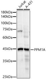 PPM1A Recombinant Rabbit Monoclonal Antibody (4C5S5)
