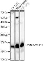 VSNL1 Antibody in Western Blot (WB)