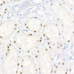 HNF1A Antibody in Immunohistochemistry (Paraffin) (IHC (P))