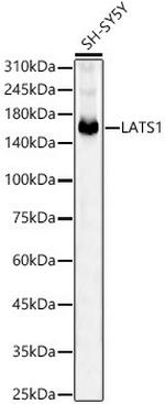 LATS1 Recombinant Rabbit Monoclonal Antibody (5I10Q5)