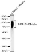 IL18R1 Recombinant Rabbit Monoclonal Antibody (3Q2D5)