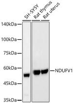 NDUFV1 Antibody in Western Blot (WB)