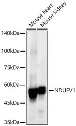 NDUFV1 Recombinant Rabbit Monoclonal Antibody (5X1W8)