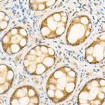 NOX4 Antibody in Immunohistochemistry (Paraffin) (IHC (P))