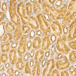 NOX4 Recombinant Rabbit Monoclonal Antibody (2B2K7)