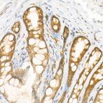 NOX4 Antibody in Immunohistochemistry (Paraffin) (IHC (P))