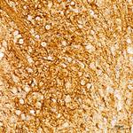 NF-H Antibody in Immunohistochemistry (Paraffin) (IHC (P))