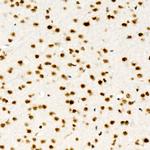 ALKBH5 Antibody in Immunohistochemistry (Paraffin) (IHC (P))