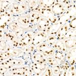 ALKBH5 Antibody in Immunohistochemistry (Paraffin) (IHC (P))