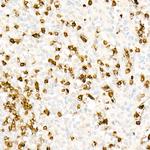 CD3z Antibody in Immunohistochemistry (Paraffin) (IHC (P))