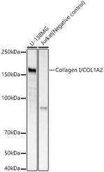 COL1A2 Antibody in Western Blot (WB)