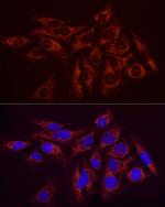SDHC Antibody in Immunocytochemistry (ICC/IF)