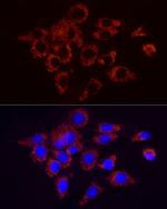 SDHC Recombinant Rabbit Monoclonal Antibody (3H2E2)