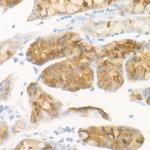 Pepsinogen II Recombinant Rabbit Monoclonal Antibody (3M7P3)