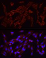 FGF2 Antibody in Immunocytochemistry (ICC/IF)