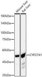 CYP27A1 Recombinant Rabbit Monoclonal Antibody (6L9D1)