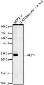Aquaporin 5 Recombinant Rabbit Monoclonal Antibody (10V2Y1)