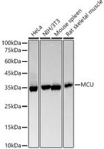 MCU Recombinant Rabbit Monoclonal Antibody (5G2I5)