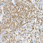 DGKA Antibody in Immunohistochemistry (Paraffin) (IHC (P))