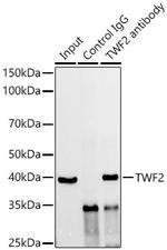 TWF2 Antibody in Immunoprecipitation (IP)