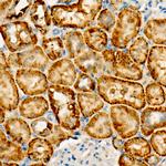 FUNDC1 Antibody in Immunohistochemistry (Paraffin) (IHC (P))