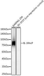 IL-1RAcP Recombinant Rabbit Monoclonal Antibody (3D6E1)