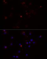 MMP3 Antibody in Immunocytochemistry (ICC/IF)