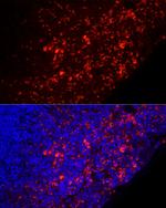 Mouse IgM Antibody in Immunocytochemistry (ICC/IF)