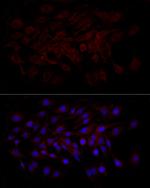 Beclin 1 Antibody in Immunocytochemistry (ICC/IF)