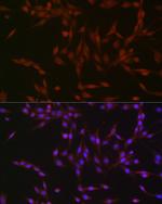 Phospho-p38 MAPK alpha (Tyr182) Antibody in Immunocytochemistry (ICC/IF)