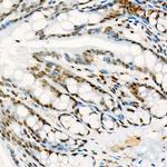 Phospho-p38 MAPK alpha (Tyr182) Antibody in Immunohistochemistry (Paraffin) (IHC (P))