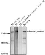 MYH11 Recombinant Rabbit Monoclonal Antibody (8L7K9)