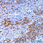 CDA Recombinant Rabbit Monoclonal Antibody (5D6N1)