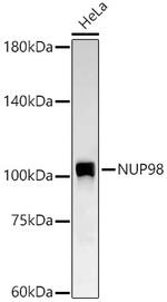 NUP98 Recombinant Rabbit Monoclonal Antibody (6M6V6)