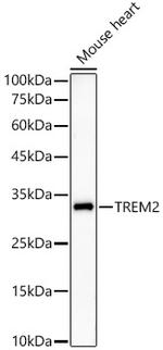 TREM2 Recombinant Rabbit Monoclonal Antibody (1L3A2)