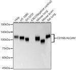 CD166 Recombinant Rabbit Monoclonal Antibody (5H9C8)