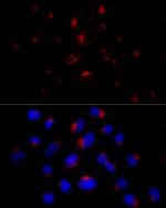 BST-2 Recombinant Rabbit Monoclonal Antibody (4L6O2)
