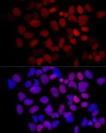 MCM2 Recombinant Rabbit Monoclonal Antibody (8E8O10)