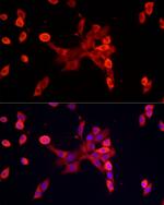 S100A10 Antibody in Immunohistochemistry (Paraffin) (IHC (P))
