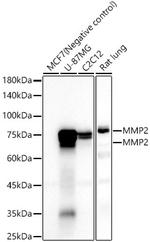 MMP2 Recombinant Rabbit Monoclonal Antibody (5I2G1)