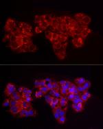 ACSL1 Antibody in Immunocytochemistry (ICC/IF)