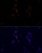 CD162 Recombinant Rabbit Monoclonal Antibody (8C3X6)