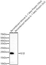 IL-1 beta Recombinant Rabbit Monoclonal Antibody (1A9G3)