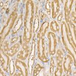 EEF1A1 Antibody in Immunohistochemistry (Paraffin) (IHC (P))