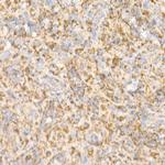 BAK Antibody in Immunohistochemistry (Paraffin) (IHC (P))