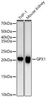 GPX1 Recombinant Rabbit Monoclonal Antibody (1H10F7)