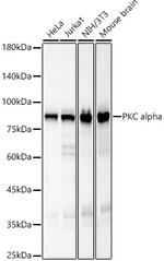 PKC alpha Recombinant Rabbit Monoclonal Antibody (8O4U8)
