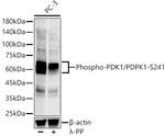 Phospho-PDPK1 (Ser241) Recombinant Rabbit Monoclonal Antibody (3P2U4)