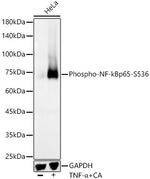 Phospho-NFkB p65 (Ser536) Antibody in Western Blot (WB)